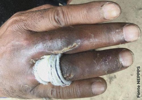 RISCOS OCUPACIONAIS E ENVELHECIMENTO DE CATADORES DE MATERIAIS RECICLÁVEIS